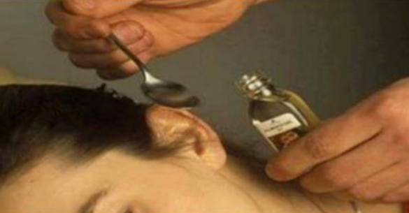 IL TRUCCO PER PULIRE L'ORECCHIO E RIMUOVERE I TAPPI DI CERUME ALL'ISTANTE E IN MODO NATURALE - 14/02/2017